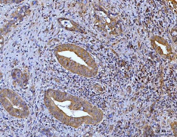  IHC analysis of Glutaminase/GLS using anti-Glutaminase/GLS antibody (M01272-2)