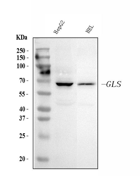  Western blot analysis of Glutaminase/GLS using anti-Glutaminase/GLS antibody (M01272-2)