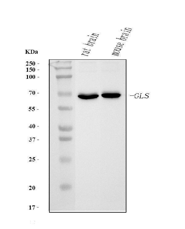  Western blot analysis of Glutaminase/GLS using anti-Glutaminase/GLS antibody (M01272-2)