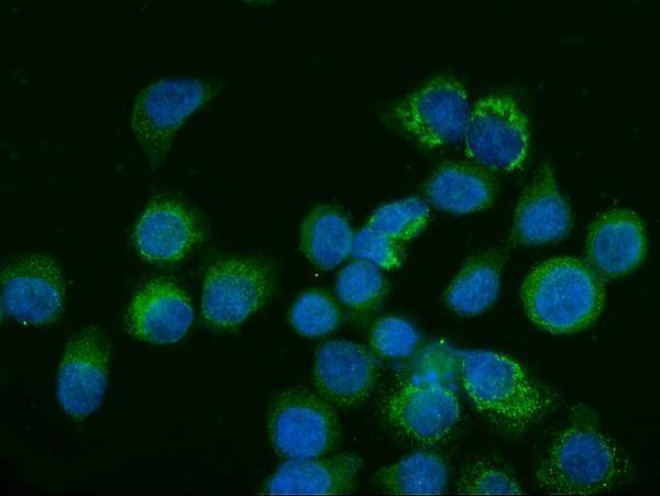 m01272 3 gls primary antibodies if testing 7