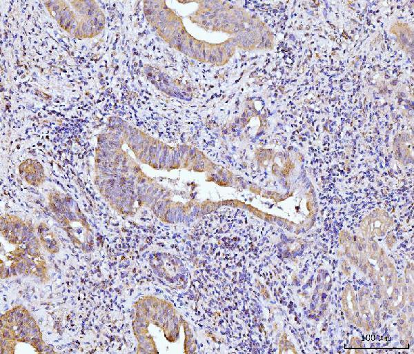  IHC analysis of Glutaminase/GLS using anti-Glutaminase/GLS antibody (M01272-3)