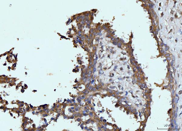 m01272 3 gls primary antibodies ihc testing 5