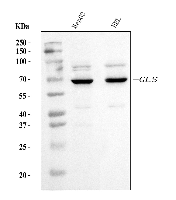  Western blot analysis of Glutaminase/GLS using anti-Glutaminase/GLS antibody (M01272-3)