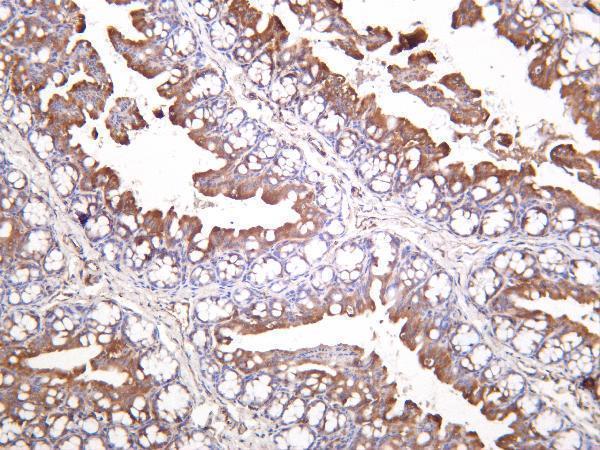 Mouse colon was stained with Anti-Glutaminase C rabbit antibody