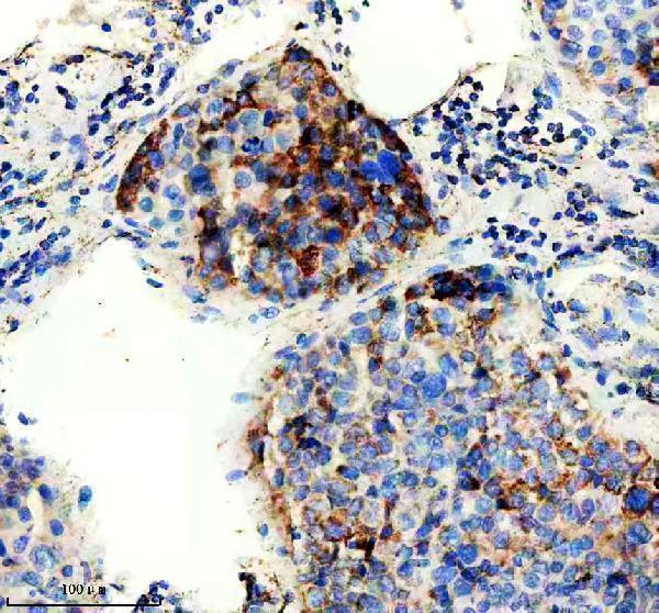 m01272 gls primary antibodies ihc testing 2