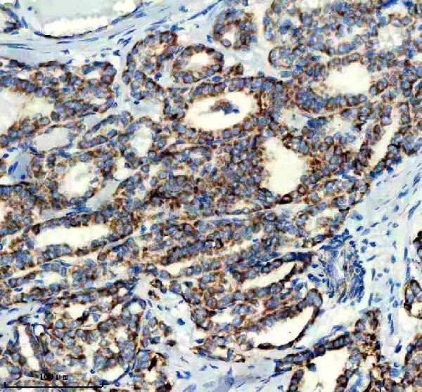 m01272 gls primary antibodies ihc testing 4
