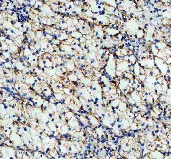 IHC analysis of GLS using anti-GLS antibody (M01272)