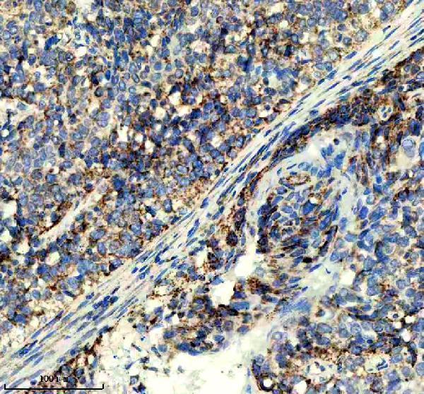 IHC analysis of GLS using anti-GLS antibody (M01272)