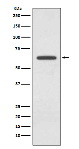 Western blot analysis of Glutaminase expression in 293T cell lysate