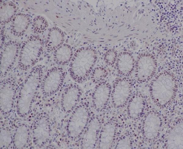 Immunohistochemical analysis of paraffin-embedded human colon, using Ku80 Antibody