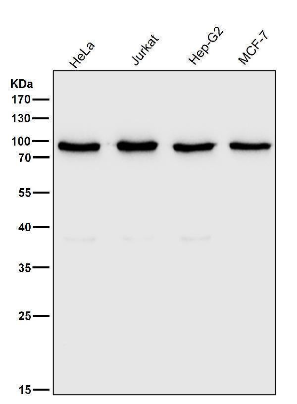All lanes use the Antibody at 1:2W dilution for 1 hour at room temperature