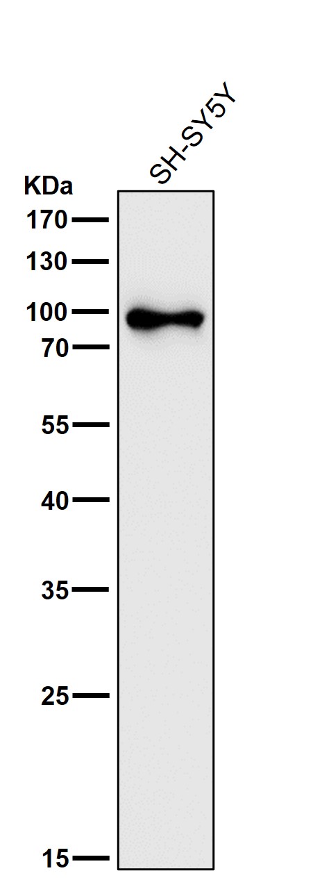 All lanes use the Antibody at 1:2W dilution for 1 hour at room temperature