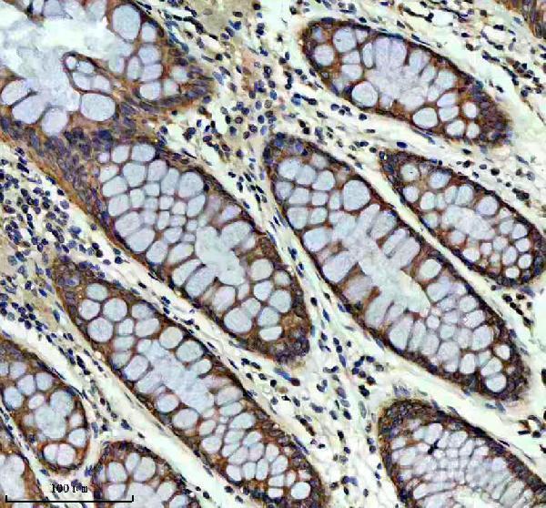 m01279 1 arf1 primary antibodies ihc testing 2