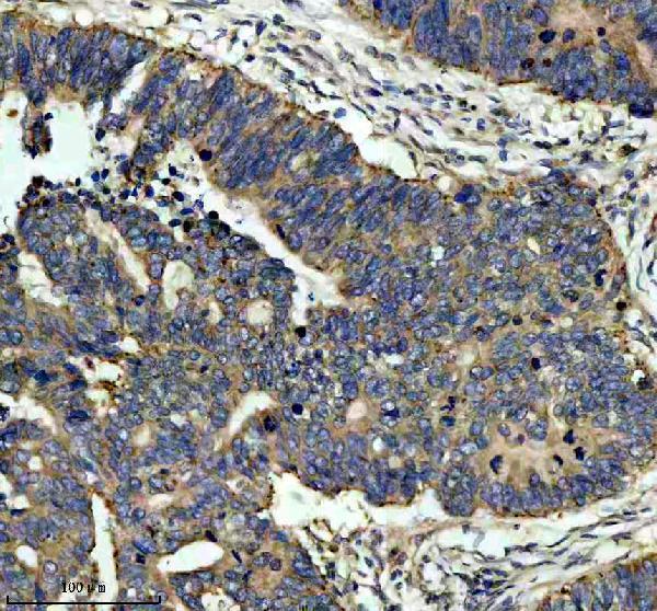 m01279 1 arf1 primary antibodies ihc testing 3