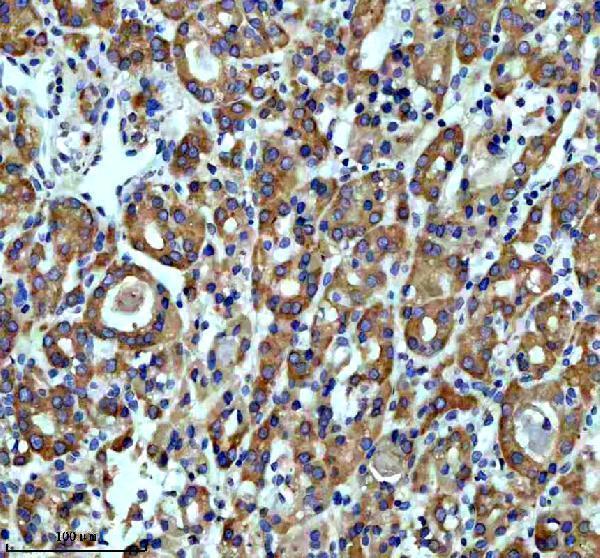 IHC analysis of ARF1 using anti-ARF1 antibody (M01279-1)