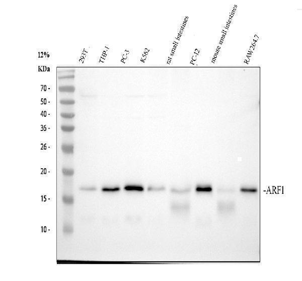 Western blot analysis of ARF1 using anti-ARF1 antibody (M01279-1)