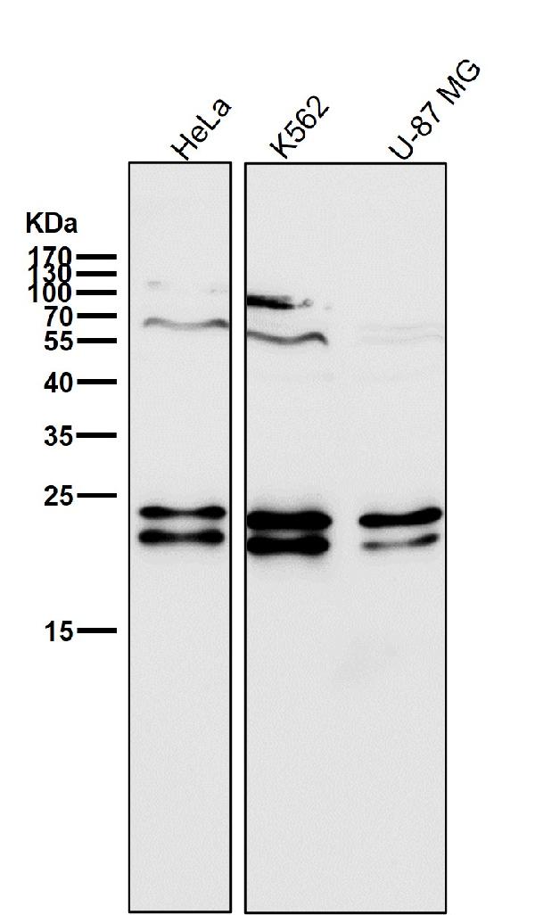 All lanes use the Antibody at 1:2K dilution for 1 hour at room temperature.