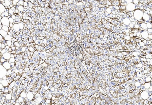 m01281 anti cd81 antibody ihc testing 4