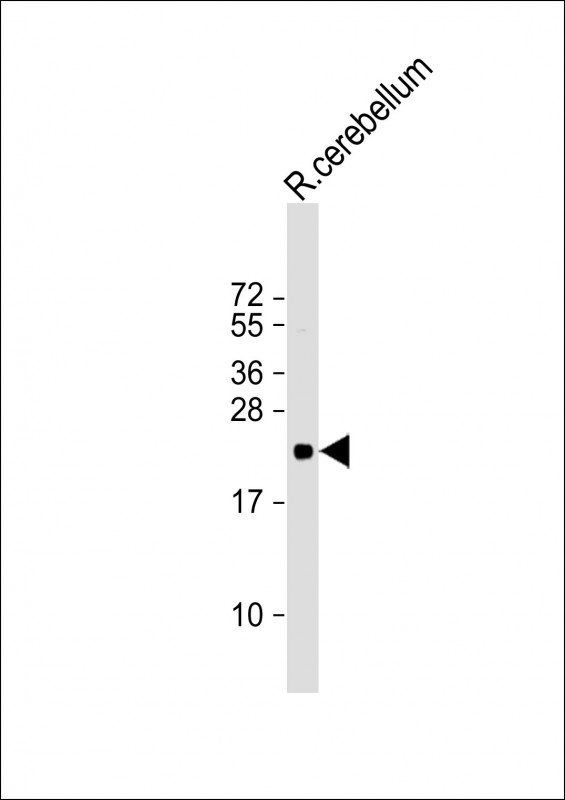 Anti-CD81 Antibody at 1:4000 dilution + rat cerebellum whole cell lysateLysates/proteins at 20 µg per lane