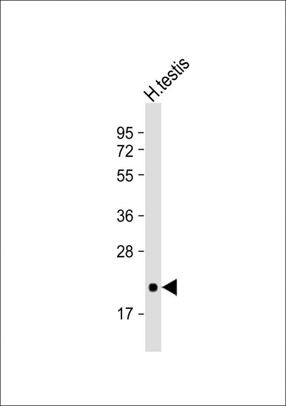 Anti-CD81 Antibody at 1:4000 dilution + human testis whole cell lysateLysates/proteins at 20 µg per lane