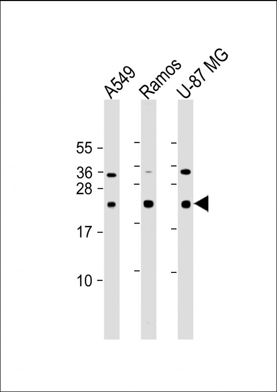 All lanes : Anti-CD81 Antibody at 1:2000 dilutionLane 1: A549 whole cell lysateLane 2: Ramos whole cell lysateLane 3: U-87 MG whole cell lysateLysates/proteins at 20 µg per lane