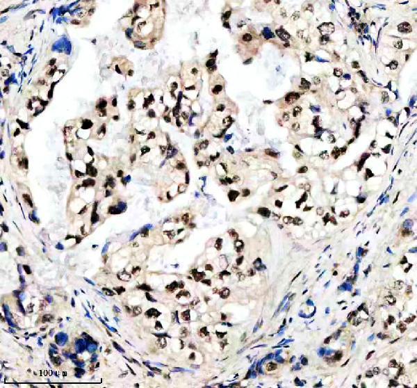 m01282 2 sumo2 3 primary antibodies ihc testing 3