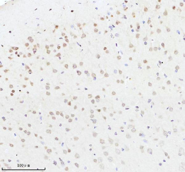 m01282 2 sumo2 3 primary antibodies ihc testing 4