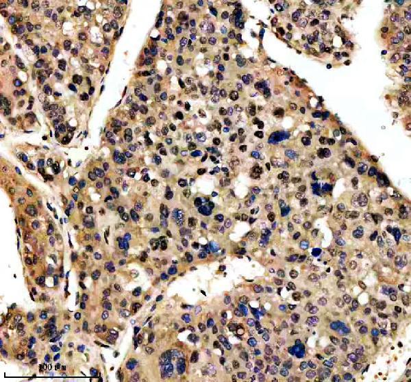 m01282 2 sumo2 3 primary antibodies ihc testing 5
