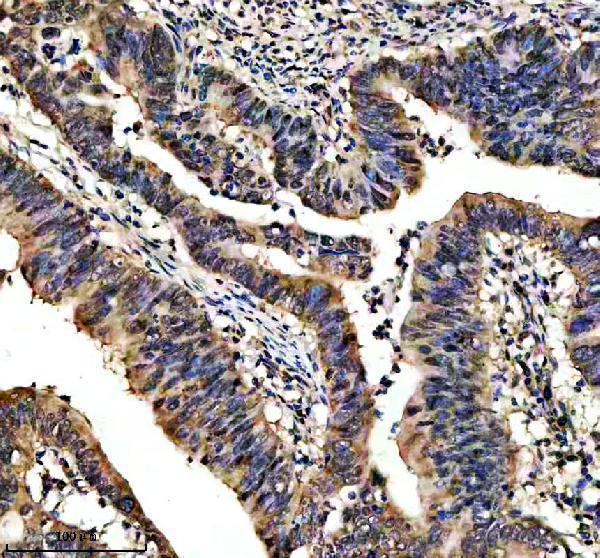m01282 2 sumo2 3 primary antibodies ihc testing 6