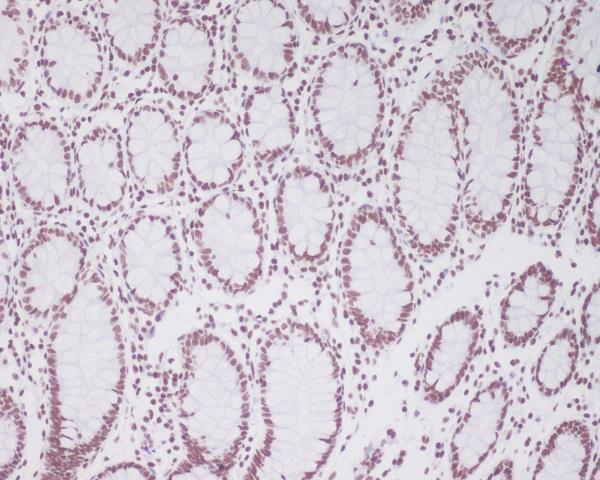 Immunohistochemical analysis of paraffin-embedded human colon using Pax2 Antibody