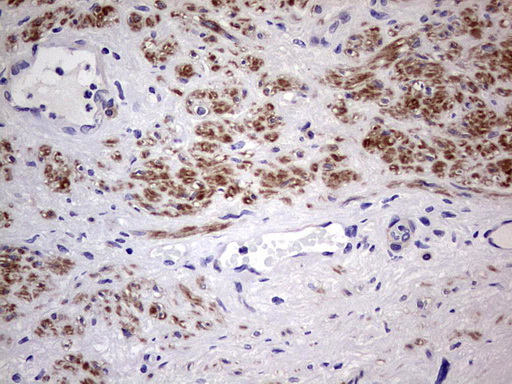 m01295 1 anti flip cflar mouse monoclonal antibody clone id oti2h8 ihc testing 2