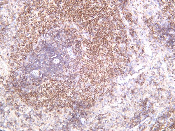 m01296 3 spn primary antibodies ihc testing 4