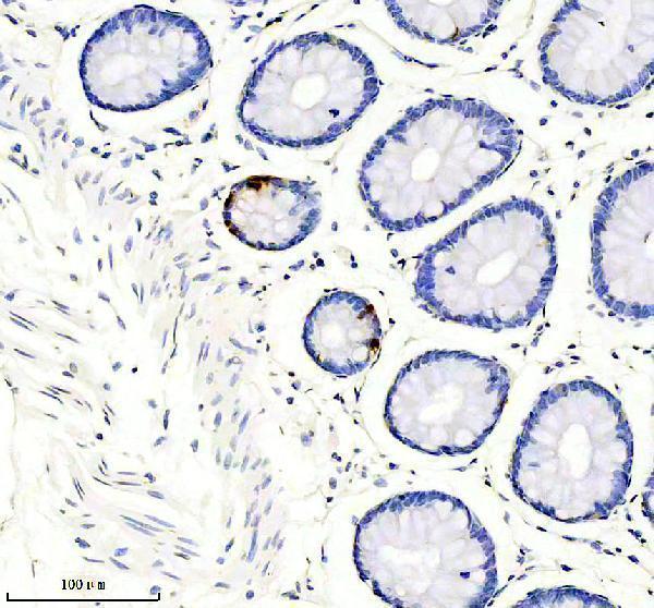 IHC analysis of Somatostatin 28 using anti-Somatostatin 28 antibody (M01297)