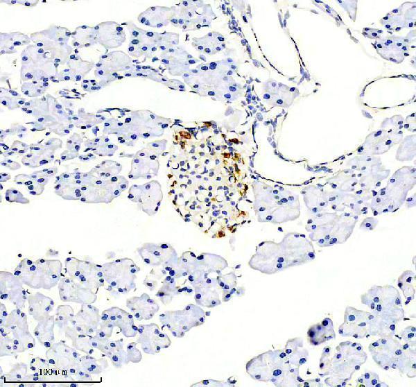 IHC analysis of Somatostatin 28 using anti-Somatostatin 28 antibody (M01297)