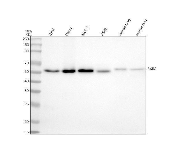  Western blot analysis of Retinoid X Receptor Alpha using anti-Retinoid X Receptor Alpha antibody (M01299-2)