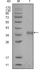 Western blotting validation for Anti-N-CoR NCOR1 Monoclonal Antibody M01304
Western Blot (WB) analysis using N-CoR Monoclonal Antibody against truncated Trx-N-CoR recombinant protein (1)