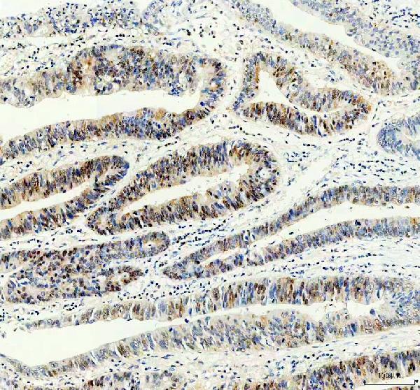 m01308 ppia primary antibodies ihc testing 3
