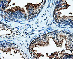 m01312 1 anti satb1 mouse monoclonal antibody clone id oti11e8 ihc testing 2