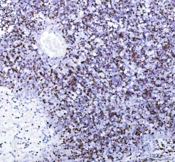  IHC analysis of STAB1 using anti-STAB1 antibody (M01312)