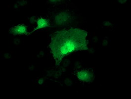 m01316 anti adh1b mouse monoclonal antibody clone id oti4f12 if testing 15