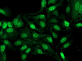 m01316 anti adh1b mouse monoclonal antibody clone id oti4f12 if testing 16