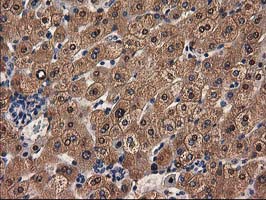 m01316 anti adh1b mouse monoclonal antibody clone id oti4f12 ihc testing 10
