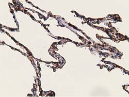 m01316 anti adh1b mouse monoclonal antibody clone id oti4f12 ihc testing 11