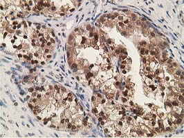 m01316 anti adh1b mouse monoclonal antibody clone id oti4f12 ihc testing 4