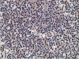 m01316 anti adh1b mouse monoclonal antibody clone id oti4f12 ihc testing 5