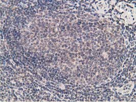 m01316 anti adh1b mouse monoclonal antibody clone id oti4f12 ihc testing 6