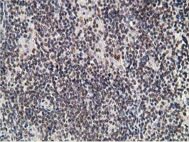m01316 anti adh1b mouse monoclonal antibody clone id oti4f12 ihc testing 7