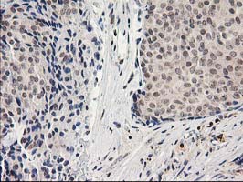 m01316 anti adh1b mouse monoclonal antibody clone id oti4f12 ihc testing 8