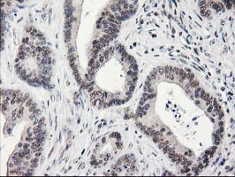 m01316 anti adh1b mouse monoclonal antibody clone id oti4f12 ihc testing 9