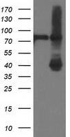 HEK293T cells were transfected with the pCMV6-ENTRY control (Left lane) or pCMV6-ENTRY ADH1B (Right lane) cDNA for 48 hrs and lysed